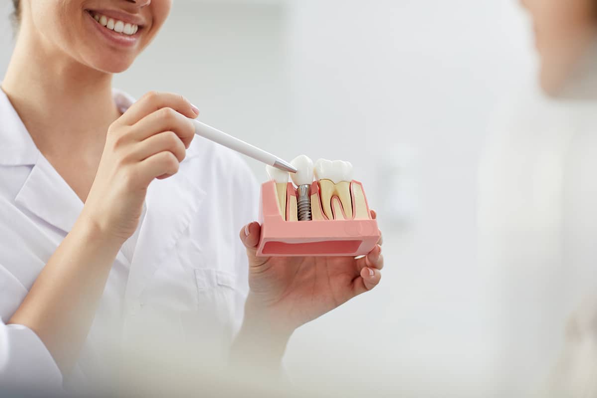 What To Expect After Dental Implant Surgery